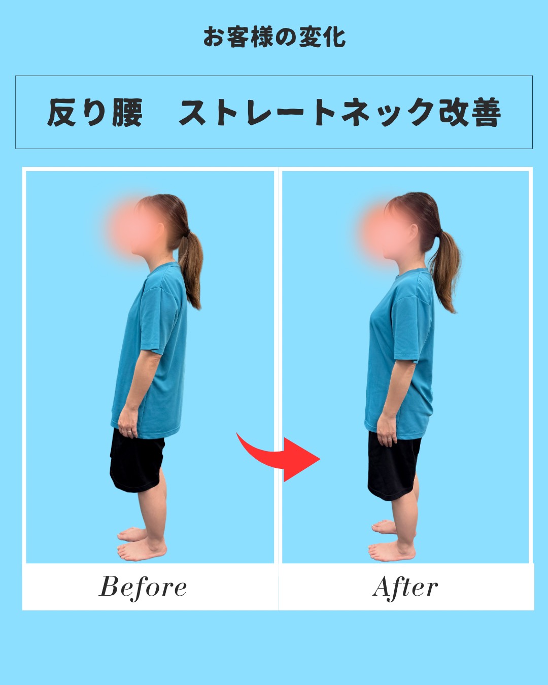 姿勢チェック Before/After